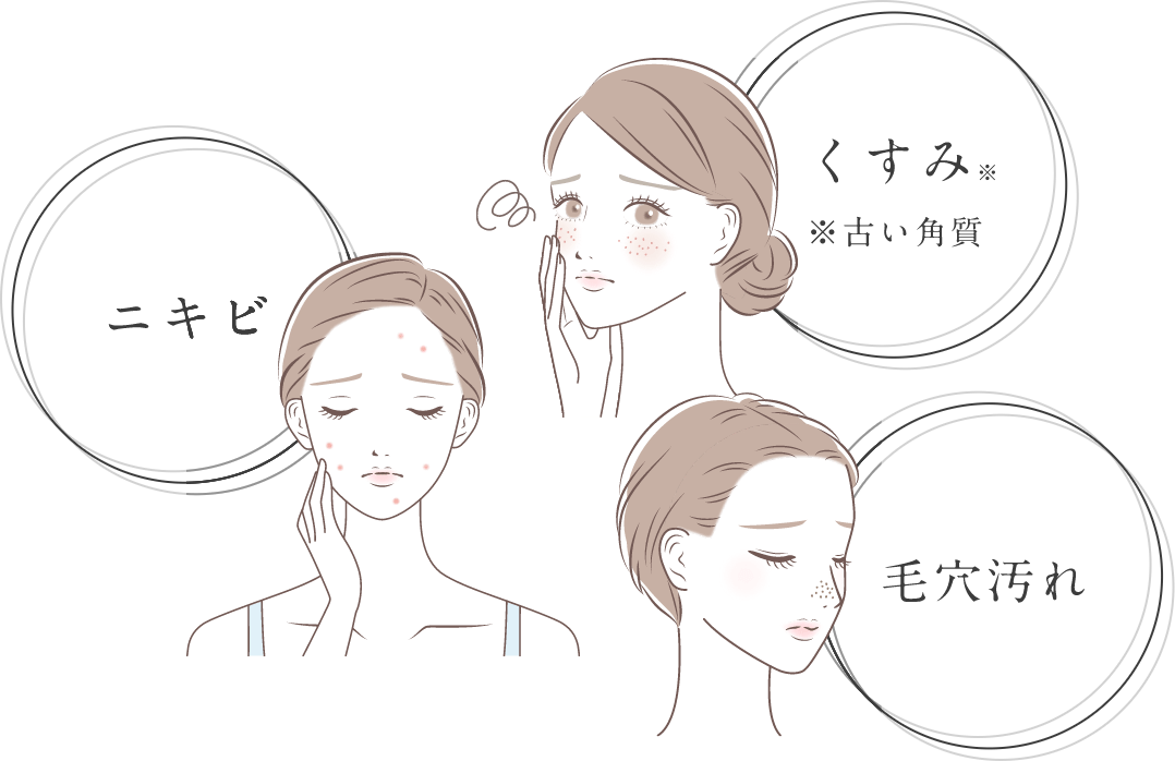 くすみ※ ※古い角質 ニキビ 毛穴汚れ