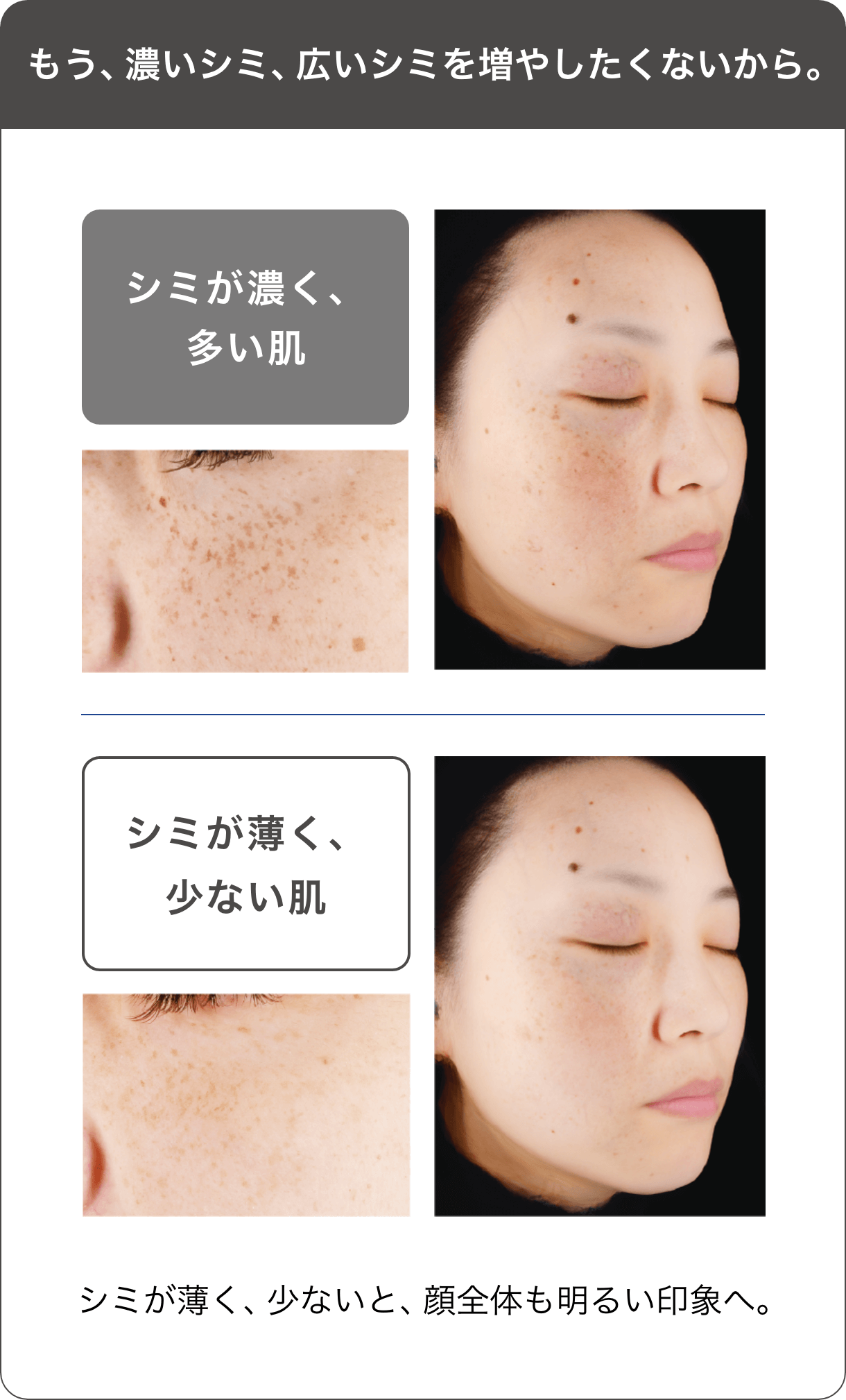 ONE BY KOSE メラノショット W 40ml 付け替え用付-